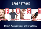 Holiday Heart Attacks:  Stroke Warning Signs and Symptoms