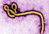 San Joaquin County Public Health System Public Health Preparedness for Ebola