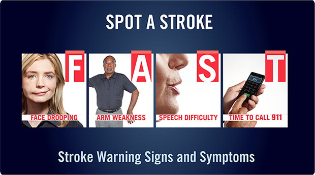 Holiday Heart Attacks:  Stroke Warning Signs and Symptoms